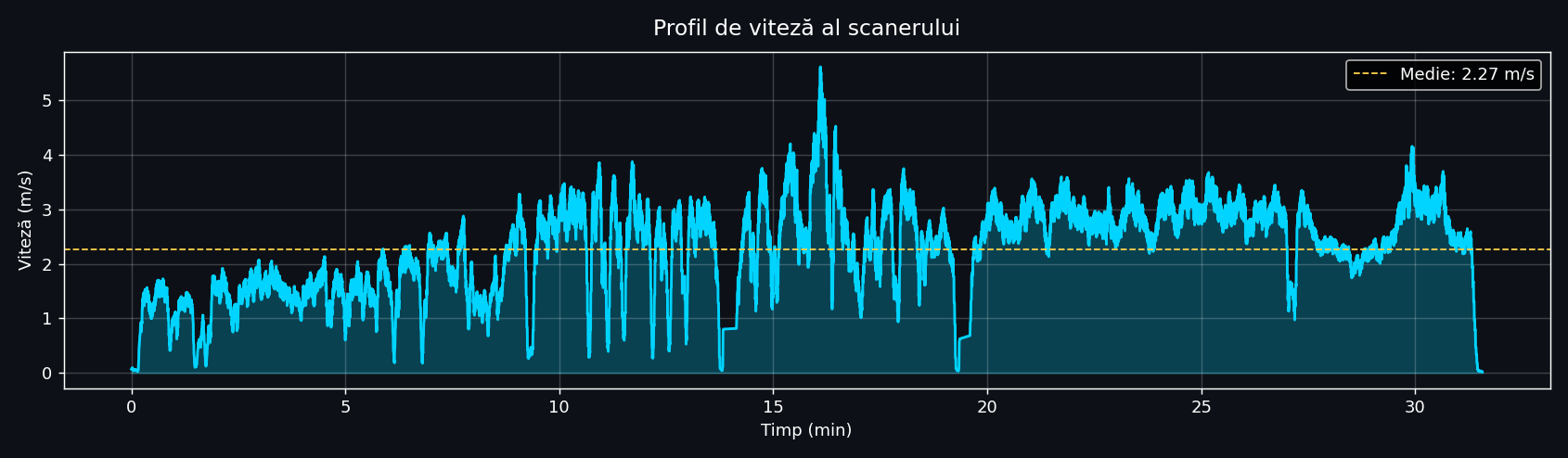 Speed profile